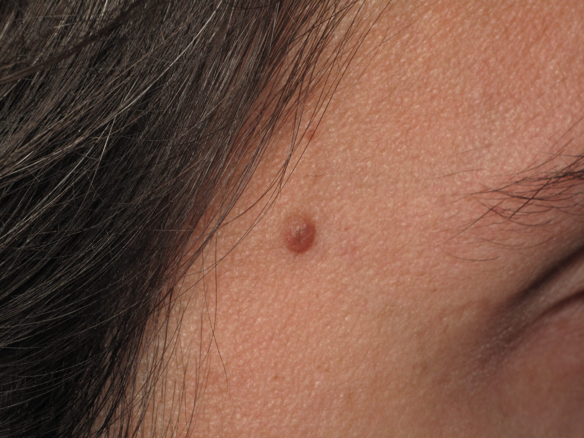 trattamento inestetismi genova